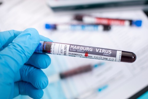 gloved hand holding test tube labeled Marburg virus